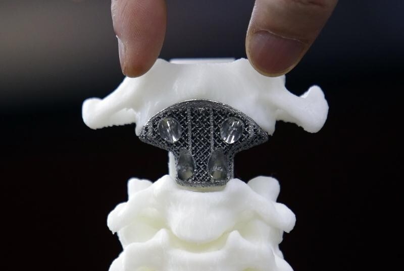 A spine model implanted with a 3D-printed artificial axis is displayed at Peking University Third Hospital in Beijing, August 14, 2014. Chinese doctor Liu Zhongjun has successfully implanted an artificial axis produced by a 3D printer into the spine of a bone cancer patient. This was the first time that an axis produced by 3D printing had been implanted into a patient, according to Liu. Normally, a diseased axis would be replaced by a standardised, hollow titanium tube, said Liu. Picture taken August 14, 2014.