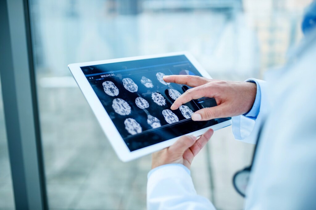 View of a brain scan; robotics transforming healthcare