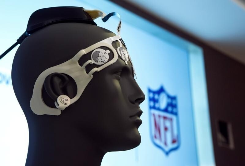 The BrainScope is pictured at a news conference in New York January 23, 2014. The NFL and General Electric announced the first round of winners, which included the company BrainScope, in the "Head Health Challenge", which awards funding for advancing research on speeding up diagnosis and improving treatment for mild traumatic brain injury. REUTERS/Eric Thayer (UNITED STATES - Tags: BUSINESS SPORT FOOTBALL HEALTH) - RTX17RH4