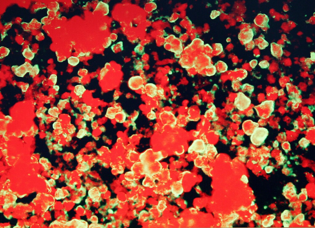 Influenza virus cells, high-lighted through a florescent microscope, are identified during tests at the World Health Organization (WHO) National Influenza Center in Bangkok on October 21, 2005. Thailand awaited test results on another suspected bird flu case on Friday after a resurgence of the killer virus in Asia, although Indonesian fears the H5N1 strain was mutating eased as a father and son proved negative. REUTERS/Adrees Latif - RTR19PG7