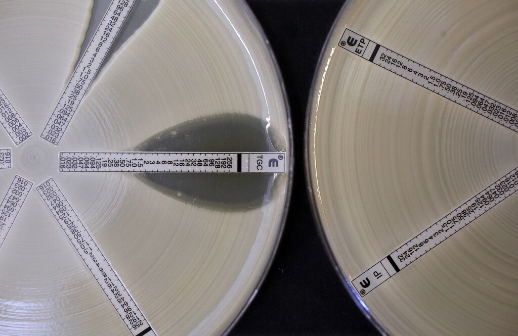 Placas científicas que contienen una bacteria resistente a los antibióticos.