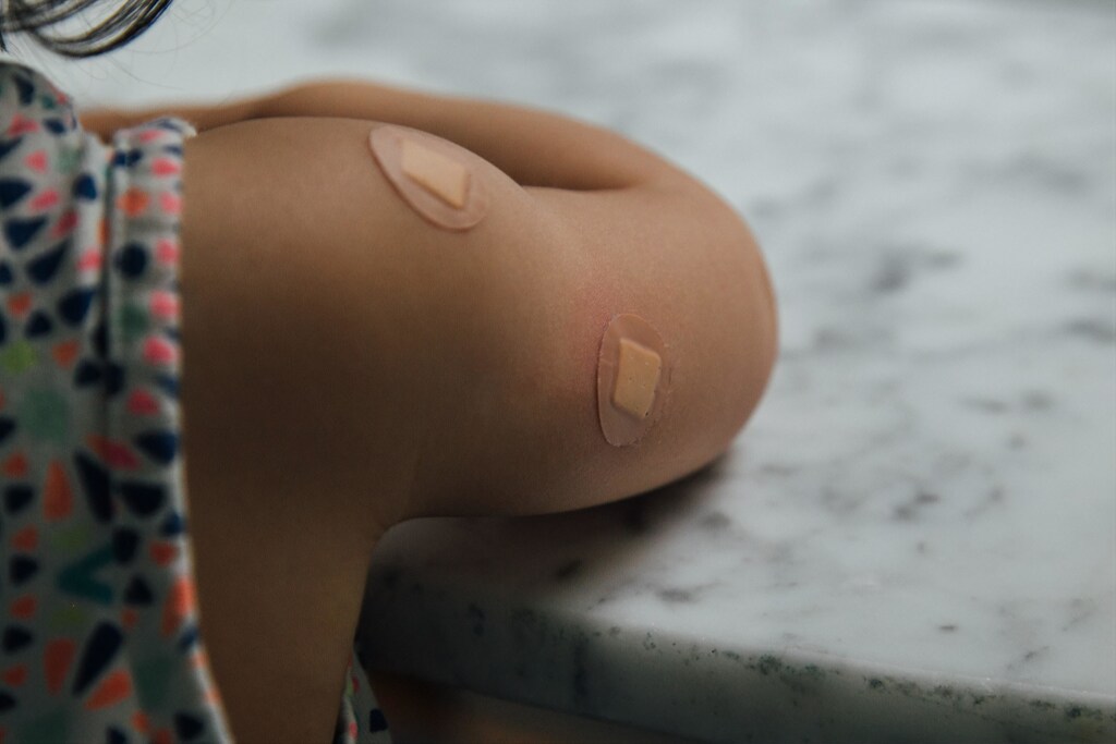 child's arm with plasters on it after she received vaccination shots