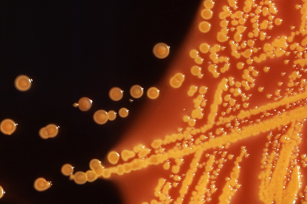 Colonies of E. coli bacteria grown on a Hektoen enteric (HE) agar plate are seen in a microscopic image courtesy of the U.S. Centers for Disease Control (CDC). File Photo - RC12C72AE570
