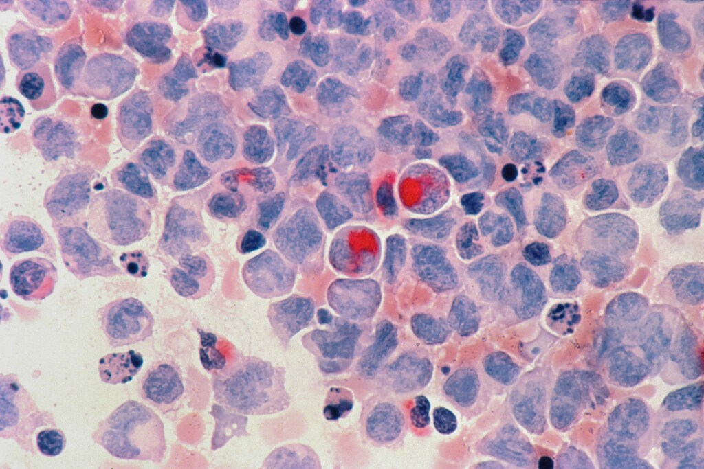 India's FIRST Cancer Care initiative aims to drive early cancer diagnosis and treatment.