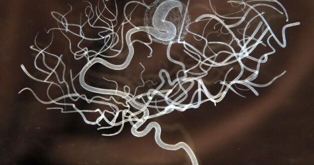 A laser-etched lead crystal glass artwork by Katherine Dowson entitled Memory of a Brain Malformation is seen at an exhibition at the Wellcome Collection in London March 27, 2012. REUTERS/Chris Helgren