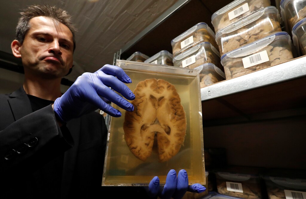 Belgian researcher Manuel Morrens holds a container filled with a slide of a human brain, part of a collection of more than 3,000 brains that could provide insight into psychiatric diseases, at the psychiatric hospital in Duffel, Belgium, July 19, 2017. REUTERS/Yves Herman - RC1CAD36E300