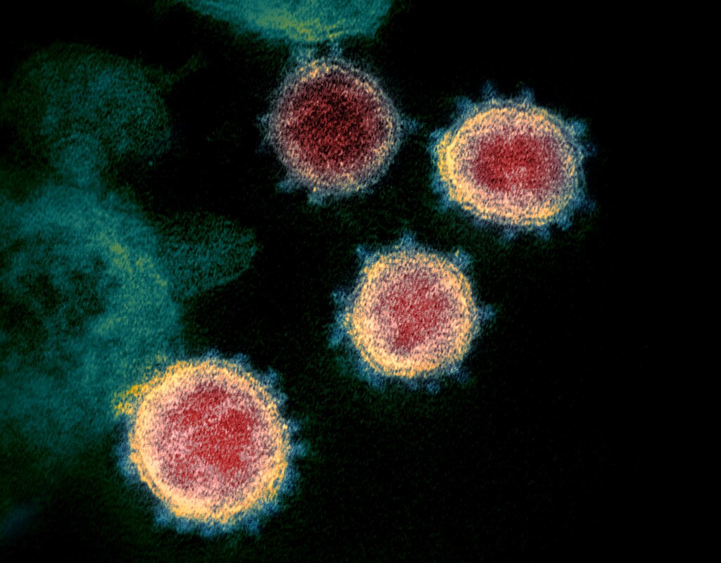 This undated transmission electron microscope image shows SARS-CoV-2, also known as novel coronavirus, the virus that causes COVID-19, isolated from a patient in the U.S. Virus particles are shown emerging from the surface of cells cultured in the lab. The spikes on the outer edge of the virus particles give coronaviruses their name, crown-like. NIAID-RML/Handout via REUTERS. THIS IMAGE HAS BEEN SUPPLIED BY A THIRD PARTY. MANDATORY CREDIT - RC25NF9B3EFR