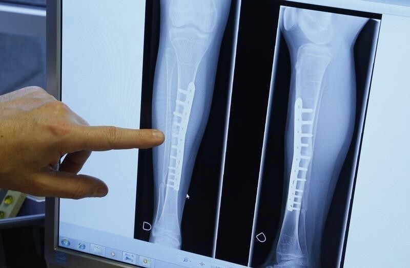 Belgian Professor Denis Dufrane, coordinator of the centre of tissue and cellular therapy of Brussels' Saint Luc Hospital, shows how a hole in the tibia of a patient suffering from a disease was treated on an x-ray, in Belgium January 14, 2014.