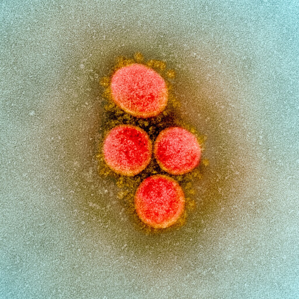 An undated transmission electron micrograph of a SARS-CoV-2 virus particle, also known as novel coronavirus, the virus which causes COVID-19, isolated from a patient. NIAID Integrated Research Facility (IRF)/Handout via REUTERS. MANDATORY CREDIT. THIS IMAGE HAS BEEN SUPPLIED BY A THIRD PARTY. - RC25NF9SIPLJ