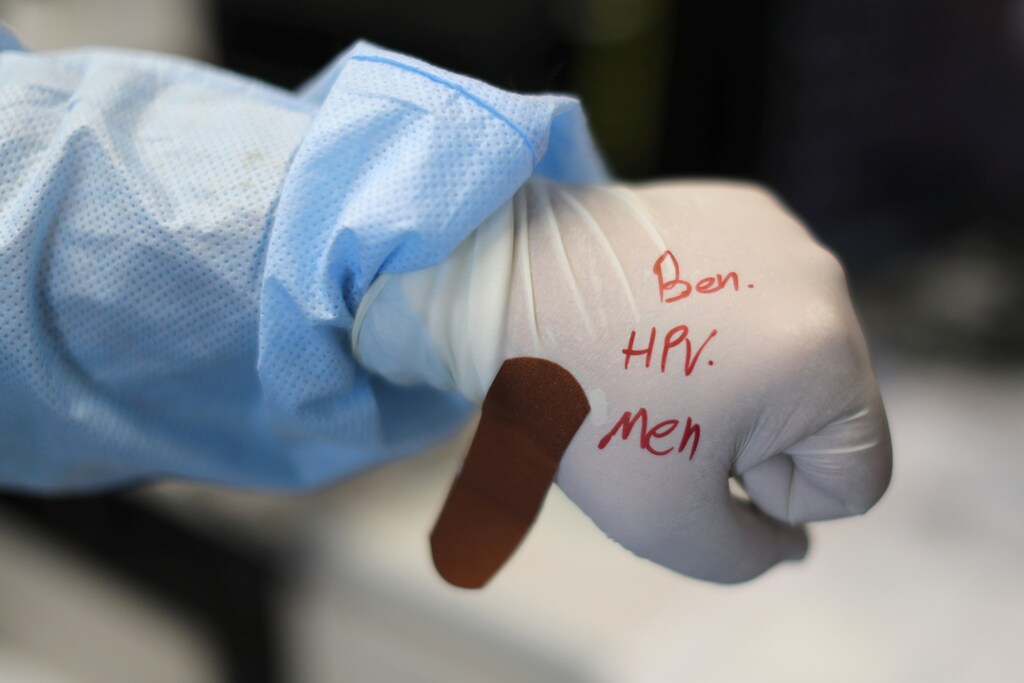 Researchers’ findings support broadening HPV vaccine coverage and increasing surveillance in the male population.