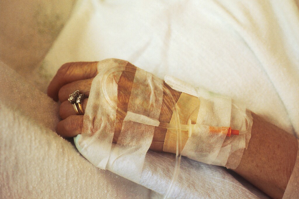 A closeup of a chemotherapy IV in a patient's hand