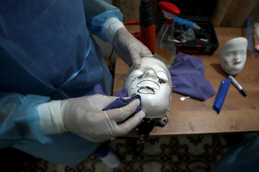 image of a physiotherapist putting a 3D transparent mask on the face of Palestinian boy Ahmed Al-Deeb, who is a burn victim of the Gaza bakery fire