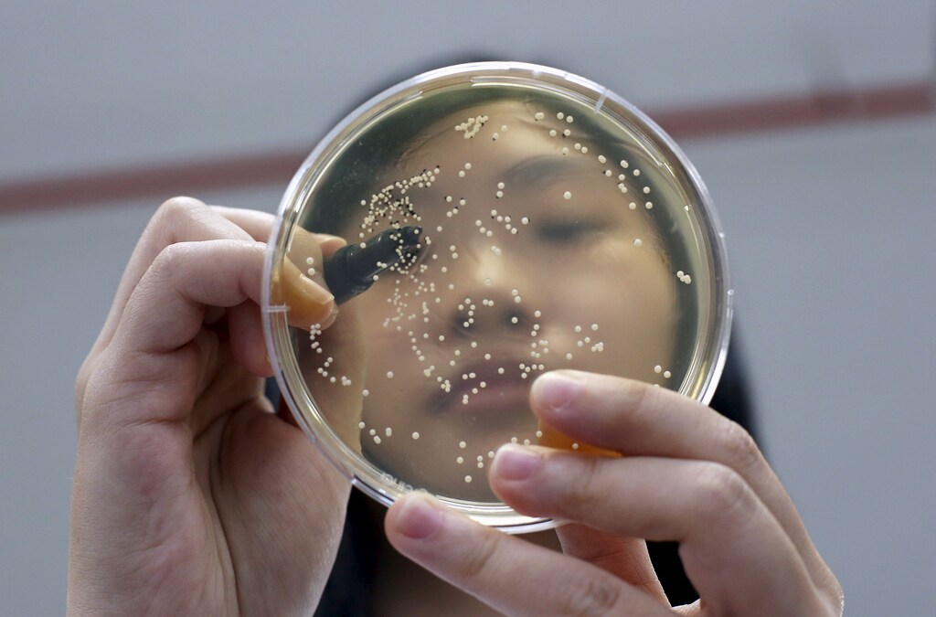 A researcher counts Lactobacillus colonies forming in a petri dish at Otemchi Biotechnology's laboratory in Singapore April 24, 2015. In barns filled with classical music and lighting that changes to match the hues outside, rows of chickens are fed a diet rich in probiotics, a regimen designed to remove the need for the drugs and chemicals that have tainted the global food chain. The Lactobacillus is produced in the lab to mix with chicken feed for Kee Song Brothers' drug-free poultry farms. Picture taken April 24, 2015. To match POULTRY-DRUG/ REUTERS/Edgar Su - GF10000092623