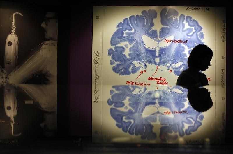A woman walks past a display of a brain slice of patient "H.M." at the press preview for the MIT 150 Exhibition at the MIT Museum, celebrating Massachusetts Institute of Technology's 150 year anniversary, in Cambridge, Massachusetts January 7, 2011. Patient H.M. has been extensively studied because of his inability to form long term memories following brain surgery in 1953 for his epilepsy. REUTERS/Brian Snyder (UNITED STATES - Tags: SOCIETY EDUCATION BUSINESS ANNIVERSARY) - GM1E71806R501
