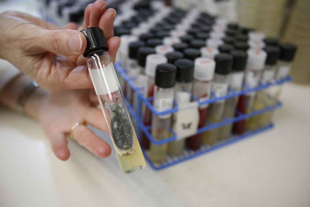 A sample of Aspergillus fumigatus.