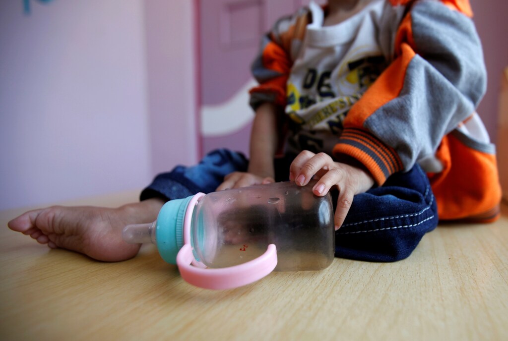 A malnourished boy holds an empty milk bottle at a hospital malnutrition intensive care unit in Sanaa, Yemen September 26, 2016. REUTERS/Khaled Abdullah SEARCH "FAMINE YEMEN" FOR THIS STORY. SEARCH "WIDER IMAGE" FOR ALL STORIES. - S1BEUFAVENAA