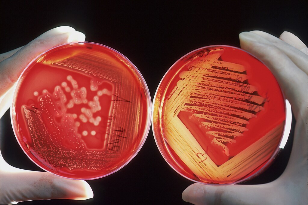 A pair of hands holding two red petri dishes used to diagnose infections prone to antimicrobial resistance