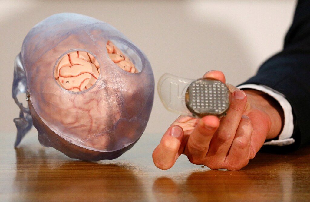 Los datos de neurotecnología son sensibles y requieren medidas de protección sólidas.