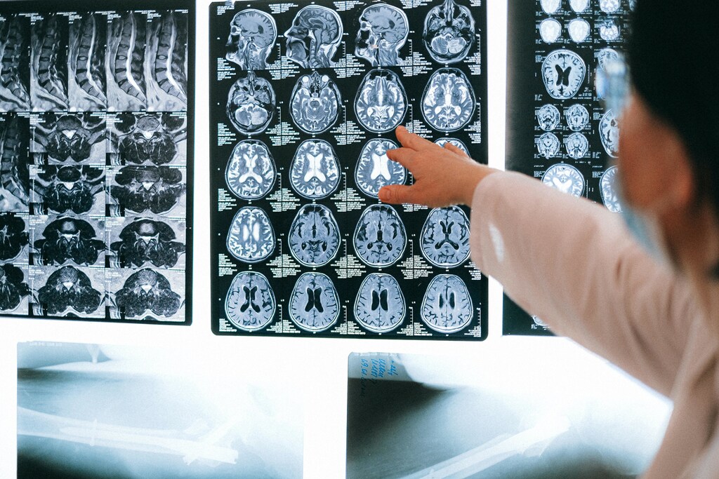 In the past, MRI images or X-rays in years had to be analyzed by doctors. Computer vision can do so in a faster and more accurate way, identifying diseases early