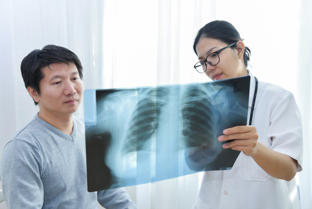 AI-enabled chest X-ray analysis can expand access to early lung cancer detection.