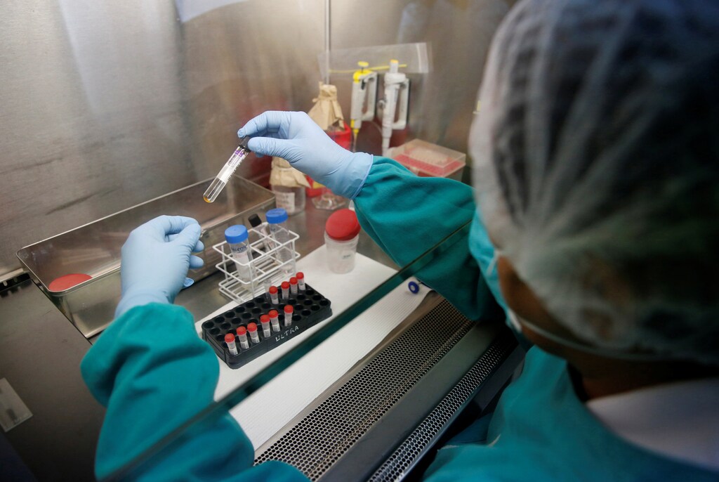 A health technician analyses blood samples for tuberculosis testing in a high-tech tuberculosis lab in Carabayllo in Lima, Peru May 19, 2016. REUTERS/Mariana Bazo SEARCH "TB HOPE" FOR THIS STORY. SEARCH "THE WIDER IMAGE" FOR ALL STORIES. - S1AEUOHDMWAA