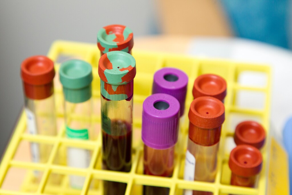 Vials of blood at the National Cancer Institute