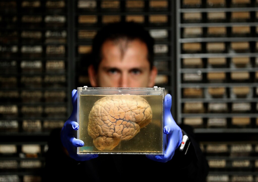 Researcher Manuel Morrens holds a container filled with a human brain, part of a collection of more than 3,000 brains that could provide insight into psychiatric diseases, at the psychiatric hospital in Duffel, Belgium, July 19, 2017. REUTERS/Yves Herman - RC15811AC830