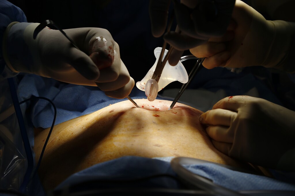 A picture of surgeons operating.