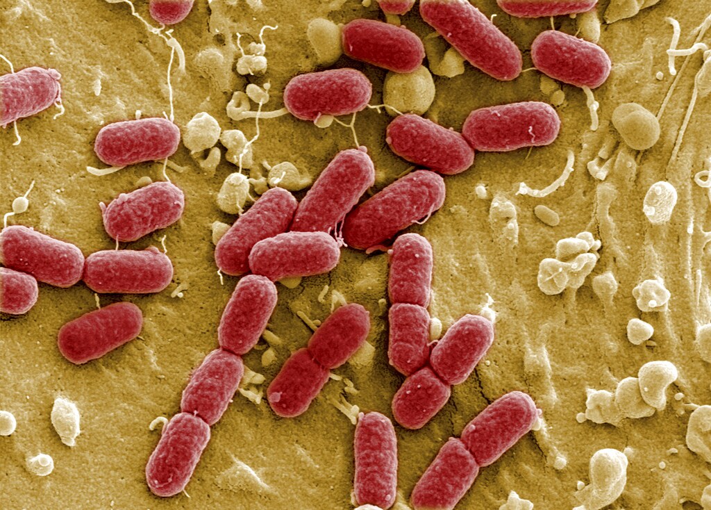 An undated file picture taken with electronic microscope shows EHEC bacteria (enterohaemorrhagic Escherichia coli) in Helmholtz Centre for Infection Research in Brunswick. German health authorities on May 25, 2011 have warned consumers to be careful with raw salad vegetables, especially those originating from northern Germany, after reporting about 140 cases and at least four deaths. REUTERS/Manfred Rohde/Helmholtz-Zentrum für Infektionsforschung (HZI) (GERMANY - Tags: SCI TECH HEALTH) THIS IMAGE HAS BEEN SUPPLIED BY A THIRD PARTY. IT IS DISTRIBUTED, EXACTLY AS RECEIVED BY REUTERS, AS A SERVICE TO CLIENTS. FOR EDITORIAL USE ONLY. NOT FOR SALE FOR MARKETING OR ADVERTISING CAMPAIGNS - BM2E75Q0S0Y01