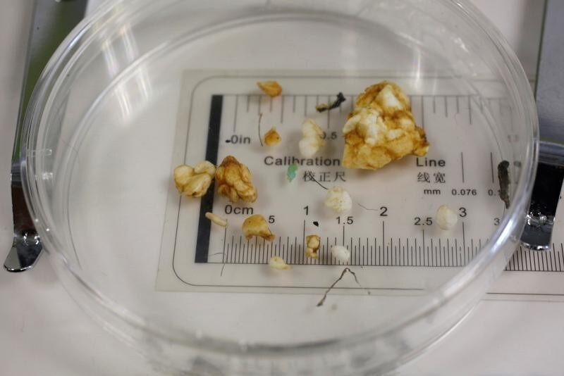 Microplastic found in some grey mullet examined by Greenpeace is displayed at a news conference in Hong Kong, China, April 23, 2018. REUTERS/Bobby Yip - RC1AE66E44F0