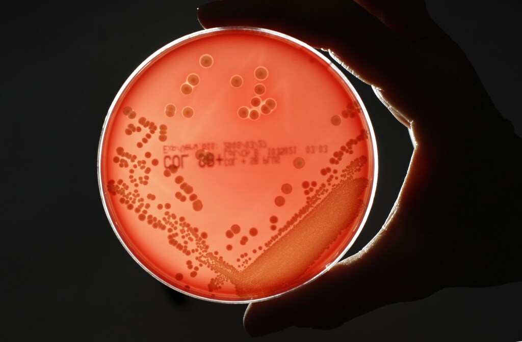 MRSA (Methicillin-resistant Staphylococcus aureus) bacteria strain is seen in a petri dish containing agar jelly for bacterial culture in a microbiological laboratory in Berlin March 1, 2008. MRSA is a drug-resistant "superbug", which can cause deadly infections. REUTERS/Fabrizio Bensch (GERMANY) - GM1E43209QY01