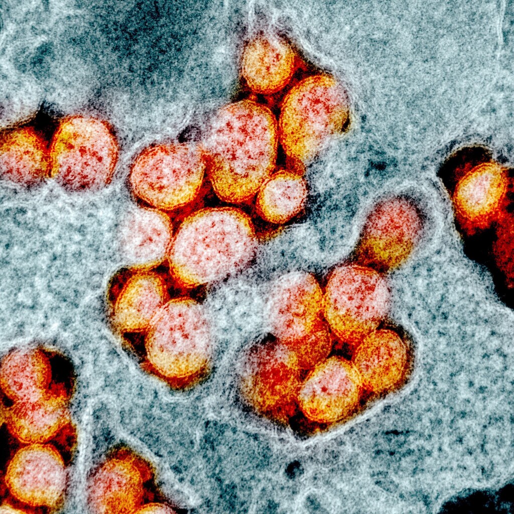 An undated transmission electron micrograph of SARS-CoV-2 virus particles, also known as novel coronavirus, the virus which causes COVID-19, isolated from a patient. NIAID Integrated Research Facility (IRF)/Handout via REUTERS. THIS IMAGE HAS BEEN SUPPLIED BY A THIRD PARTY. MANDATORY CREDIT - RC25NF95VFP1