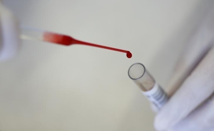 A laboratory technician tests donor blood in the 'Bayerisches Rotes Kreuz' blood transfusion service laboratory in Munich, Germany, September 5, 2016. REUTERS/Michaela Rehle