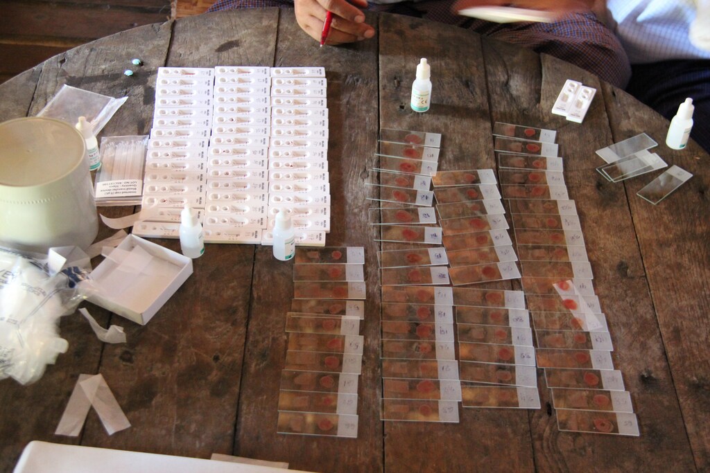 Malaria tests are seen on a table in the Ta Gay Laung village hall in Hpa-An district in Kayin state, south-eastern Myanmar, November 28, 2014. Malaria death rates dropped by 47 percent between 2000 and 2014 worldwide but it still killed some 584,000 people in 2013, most of them in sub-Saharan Africa, according to the World Health Organization (WHO). Much of the success in fighting the disease is due to the use of combination therapies (ACTs) based on artemisinin, a Chinese herb derivative, which is now under threat as malaria parasites have been building up resistance to the drugs. Experts say Myanmar, which has the largest malaria burden in the region, is the next frontier in the spread of resistance to artemisinin. Picture taken November 28, 2014. To match Feature HEALTH-MYANMAR/MALARIA