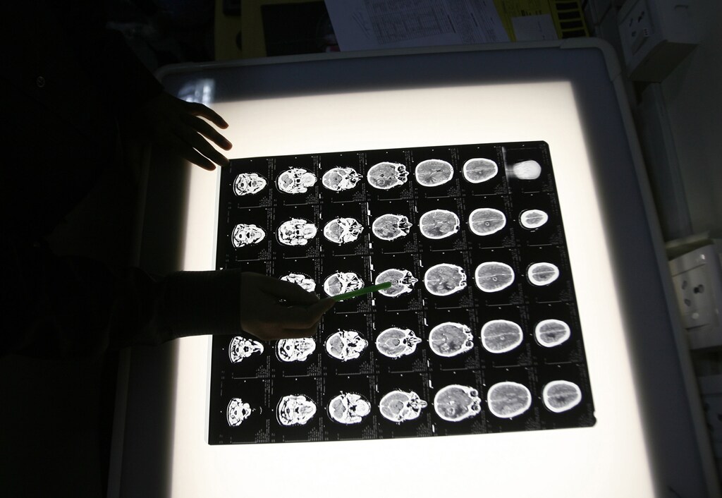 A radiologist examines the brain X-rays of a patient who underwent a cancer prevention medical check-up at the North Bengal Oncology Center, a cancer hospital, on the outskirts of the eastern Indian city of Siliguri February 25, 2009. REUTERS/Rupak De Chowdhur