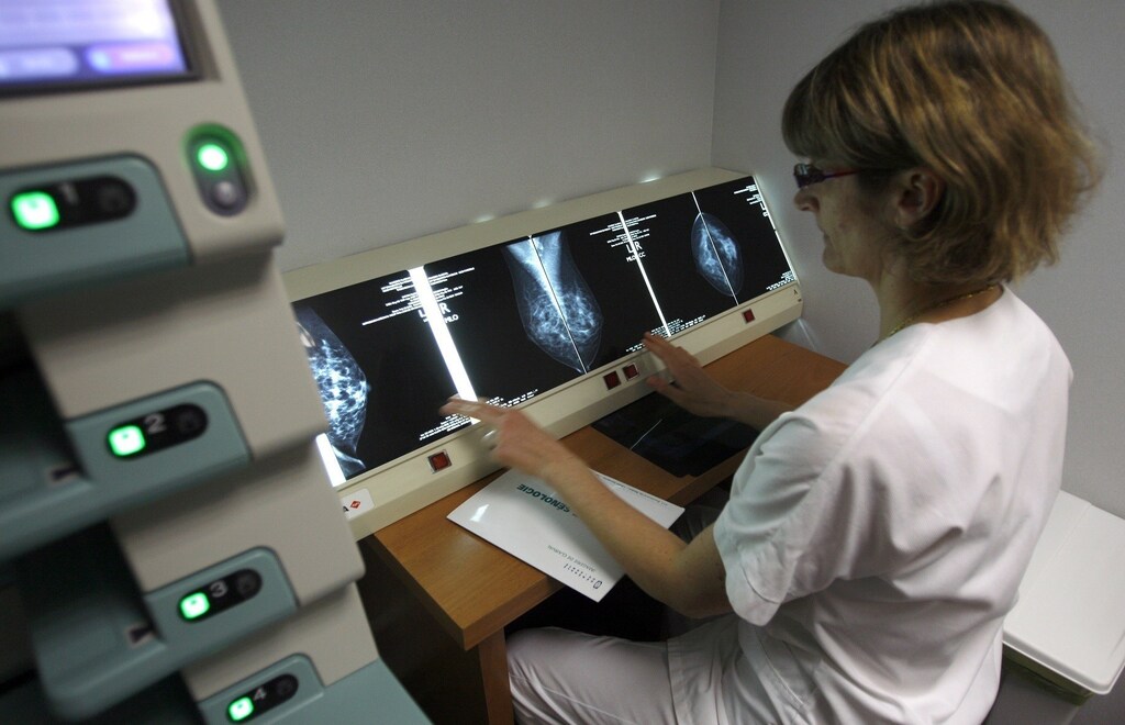 A radiologist examines breast X-rays after a cancer prevention medical check-up at the Ambroise Pare hospital in Marseille, southern France, on April 3, 2008. REUTERS/Jean-Paul Pelissier (FRANCE) - RTR1Z2TF