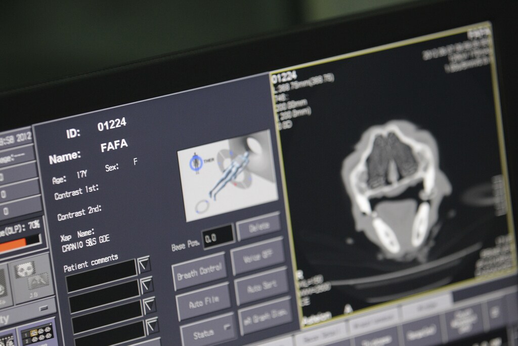 The CT scan of the brain of Fafa, a lioness that is nearly 18-year-old, is seen at a veterinary clinic in Brasilia August 7, 2012. Fafa has been living in Brasilia Zoo since its birth and had undergone surgery this year to remove both its ovaries and uterus. Fafa was sedated and brought to the veterinary clinic after experiencing seizures and bleeding. According to veterinarian John Nardott Ricardo, the lioness had to undergo a 3-hour-long session of CT scans to its chest, skull and abdomen in order to diagnose the source of its health problems. Nardott believes there is a possibility that Fafa has liver damage, which may have arisen from a cancerous tumour Fafa had in 2010. REUTERS/Ueslei Marcelino (BRAZIL - Tags: ANIMALS SOCIETY) - GM2E8880DJV02