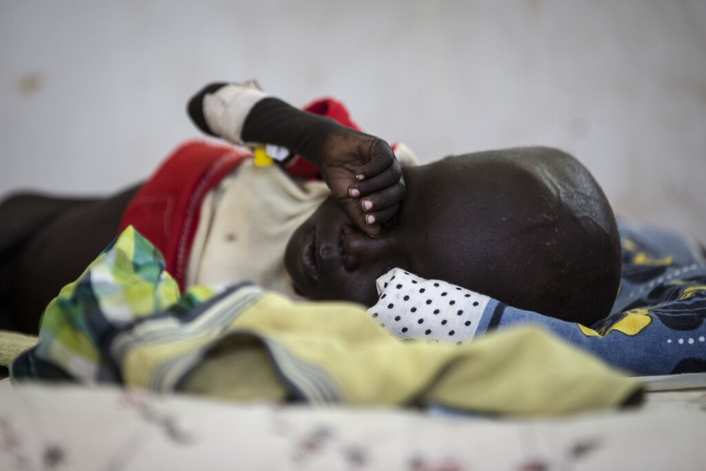 A sick child lies in a bed in a UNICEF supported hospital in Juba, South Sudan, January 24, 2017. In 2017 in South Sudan, ongoing insecurity, combined with an economic crisis that has pushed inflation above 800 percent, has created widespread food insecurity with malnutrition among children having reached emergency levels in most parts of the country. In 2016, UNICEF and partners admitted 184,000 children for treatment of severe malnutrition. That is 50 percent higher than the number treated in 2015 and an increase of 135 percent over 2014.In February 2017, war and a collapsing economy have left some 100,000 people facing starvation in parts of South Sudan where famine was declared 20 February, three UN agencies warned. A further 1 million people are classified as being on the brink of famine. The Food and Agriculture Organization of the United Nations (FAO), the United Nations Childrens Fund (UNICEF) and the World Food Programme (WFP) also warned that urgent action is needed to prevent more people from dying of hunger. If sustained and adequate assistance is delivered urgently, the hunger situation can be improved in the coming months and further suffering mitigated. The total number of food insecure people is expected to rise to 5.5 million at the height of the lean season in July if nothing is done to curb the severity and spread of the food crisis. According to the Integrated Food Security Phase Classification (IPC) update released 20 February by the government, the three agencies and other humanitarian partners, 4.9 million people more than 40 percent of South Sudans population are in need of urgent food, agriculture and nutrition assistance. Unimpeded humanitarian access to everyone facing famine, or at risk of famine, is urgently needed to reverse the escalating catastrophe, the UN agencies urged. Further spread of famine can only be prevented if humanitarian assistance is scaled up and reaches the most vulnerable. Famine is currently a