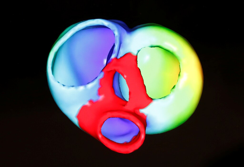 A monitor shows a three-dimensional image of a human heart at the Klaus-Tschira-Institute for Integrative Computational Cardiology, department of the Heidelberg University Hospital (Universitaetsklinikum Heidelberg), in Heidelberg, Germany, August 14, 2018. Picture taken August 14, 2018