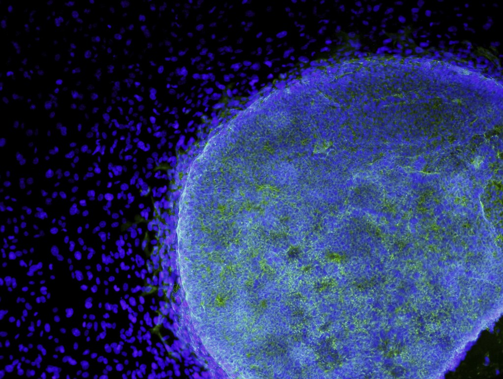 A microscopic view shows a colony of human embryonic stem cells (light blue) growing on fibroblasts (dark blue) in this handout photo released to Reuters by the California Institute for Regenerative Medicine, March 9, 2009. U.S. President Barack Obama has lifted restrictions on federal funding of human embryonic stem cell research, angering abortion opponents but cheering those who believe the study could produce treatments for many diseases.