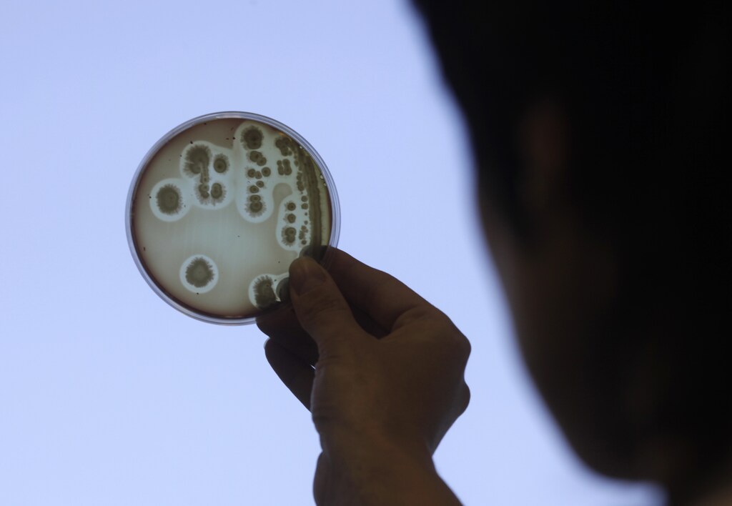 Specialist Jelena Kovalkova looks at a petri dish as she works to isolate the Escherichia coli (E.coli) bacteria strain at the Institute of Food Safety, Animal Health and Environment in Riga June 9, 2011. More than 1,600 people have been infected by a toxic strain of E.coli bacteria that has killed at least 17 and may be the deadliest yet in human history. Latvian government officials on Thursday informed media of stringent monitoring and control over its food sources, and the country has yet to be hit with any E.coli related cases. REUTERS/Ints Kalnins (LATVIA - Tags: ENVIRONMENT HEALTH SCI TECH) - GM1E7691QQ301
