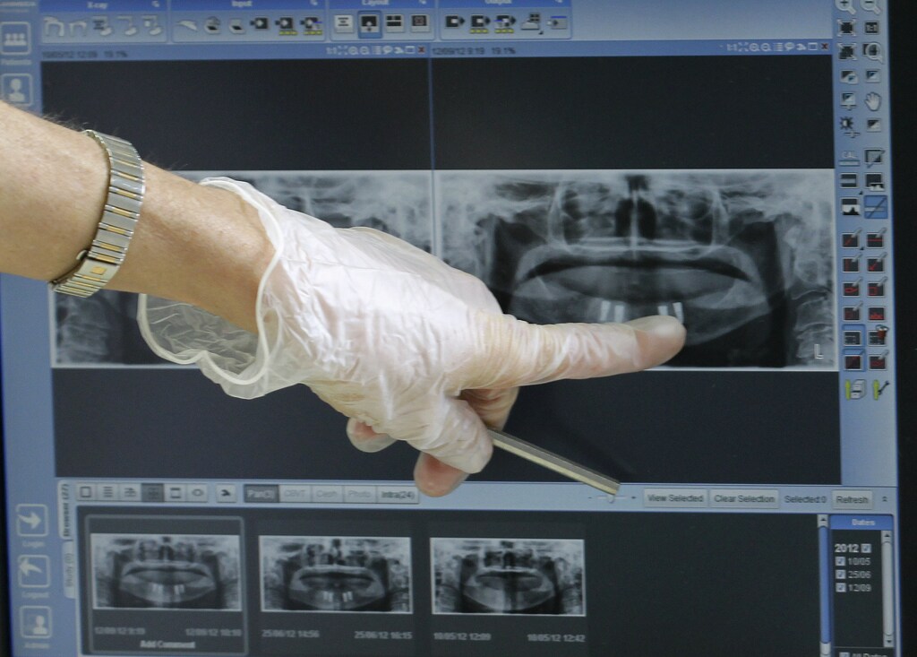 A dentist shows a radiograph of a mouth belonging to a U.S. patient, at a dental clinic in San Jose, November 1, 2012. Around 40,000 medical tourists visited Costa Rica last year, compared to 36,000 in 2010 and 30,000 in 2009. Most of them are American and Canadian, according to the country's tourism institute, ICT. Of that number, almost 15,000 of them traveled for dental care, said Massimo Manzi, director at Promed, the council for international promotion of medicine in Costa Rica. Picture taken November 1, 2012. REUTERS/Juan Carlos Ulate (COSTA RICA - Tags: HEALTH SOCIETY TRAVEL) - RTR3AWYI