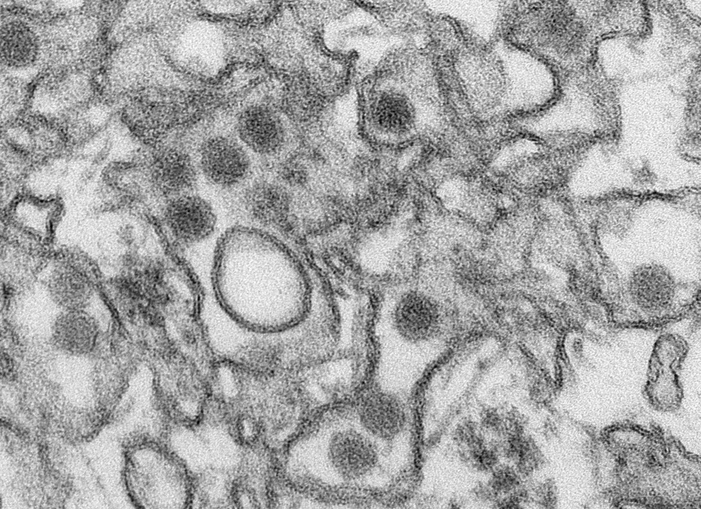 A transmission electron micrograph (TEM) shows the Zika virus, in an undated photo provided by the Centers For Disease Control in Atlanta, Georgia. The U.S. Centers for Disease Control and Prevention (CDC) extended its travel warning to another eight countries or territories that pose a risk of infection with Zika, a mosquito-borne virus spreading through the Caribbean and Latin America.