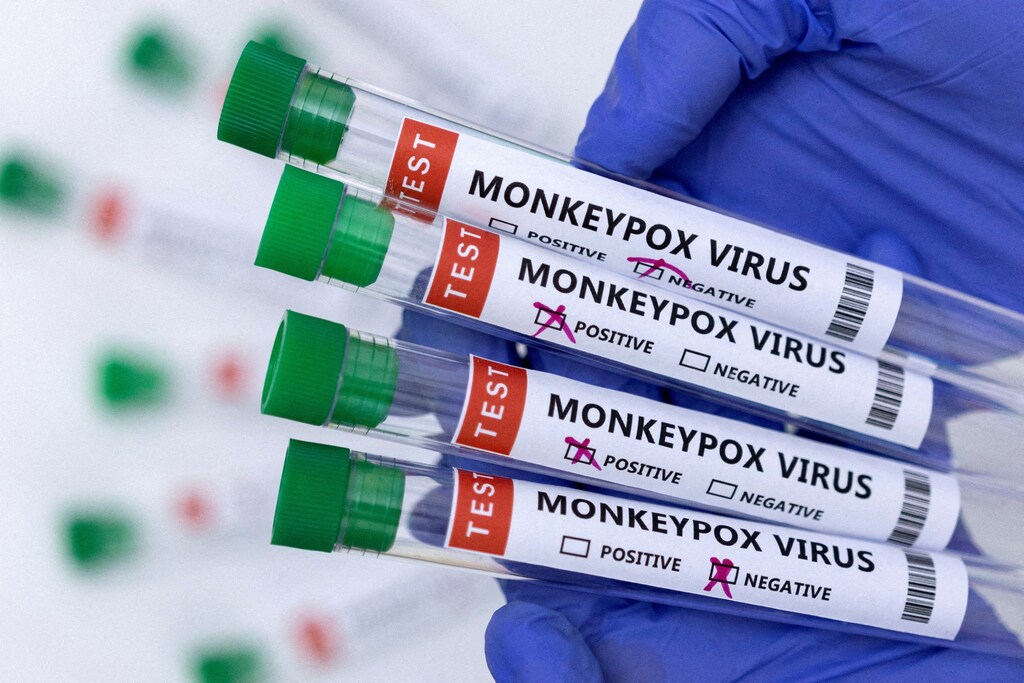 Test tubes labelled "Monkeypox virus positive and negative".