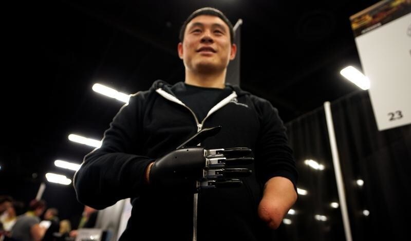 Mincheng Ni, who lost both his hands in an accident, demonstrates a Brain Robotics artificial intelligence powered prosthetic hand at CES in Las Vegas, Nevada, U.S. January 7, 2018.