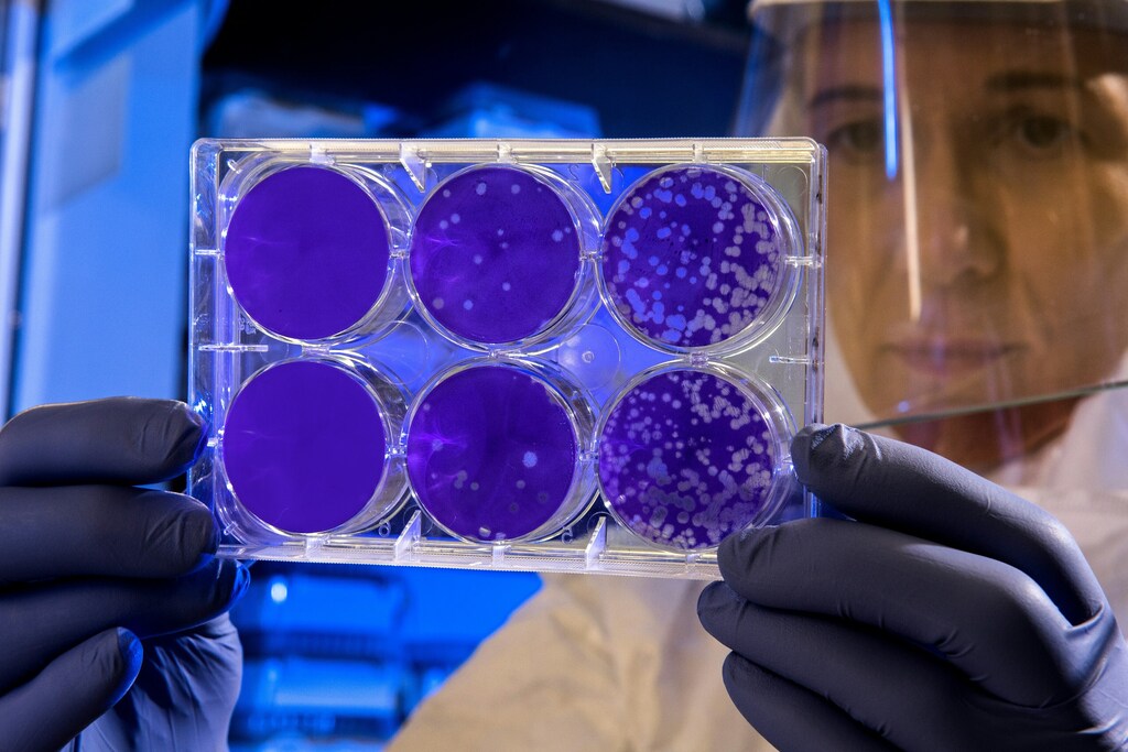 Petri dishes.