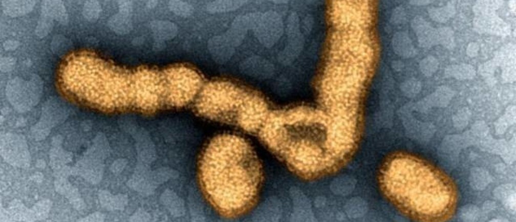 Understanding India’s swine flu outbreak