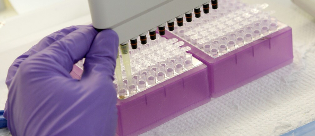 一つの遺伝子が自閉症と統合失調症に果たす役割