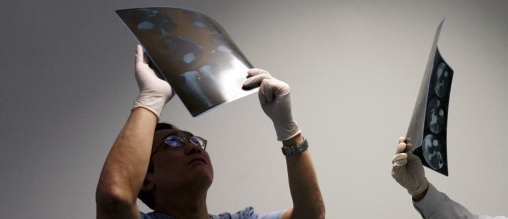 Cómo afectarán al mundo las reformas sanitarias de China