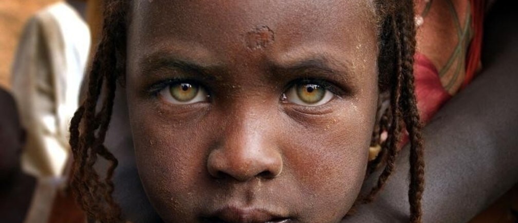Why Africa needs more humanitarian action
